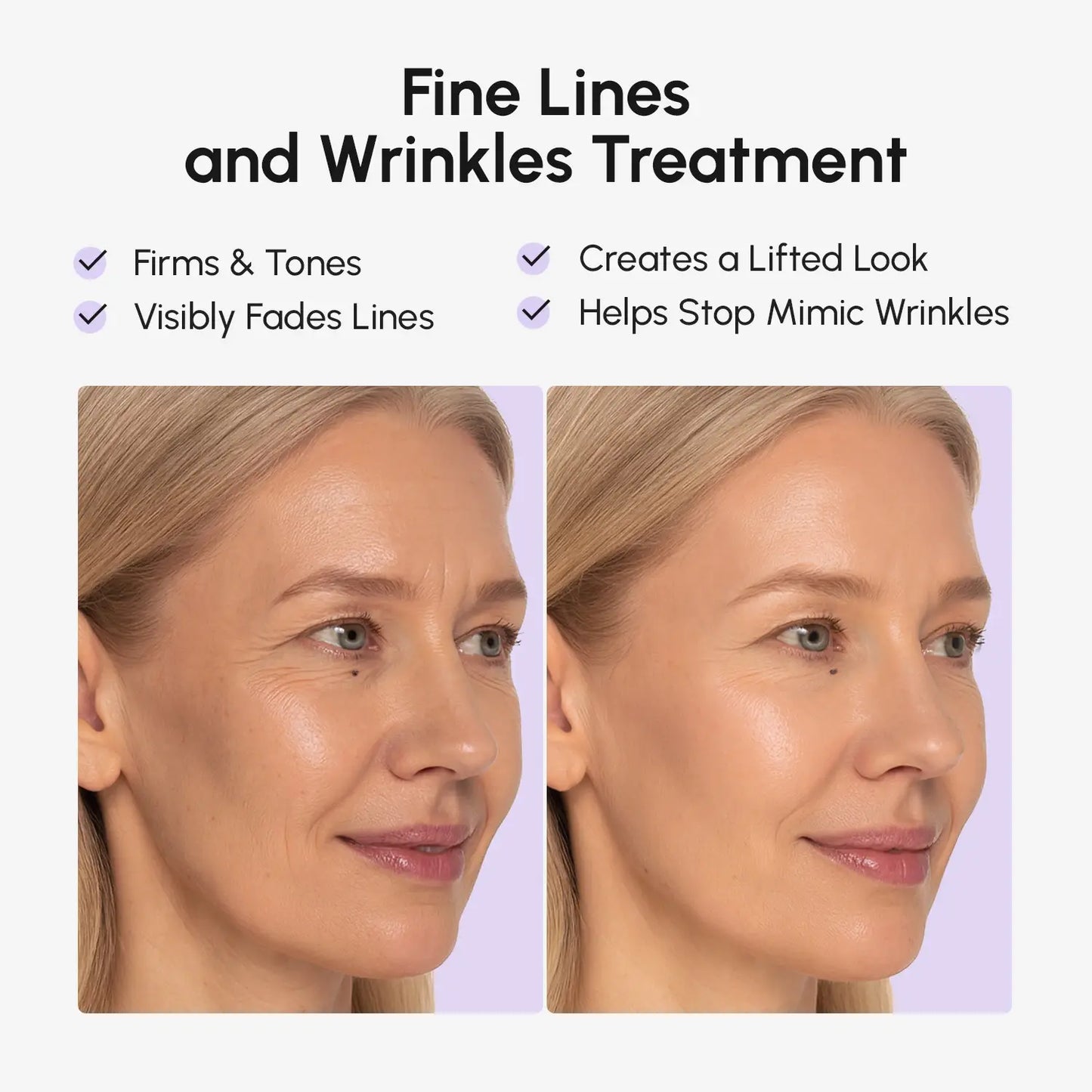 Anti-wrinkle Tape Patches